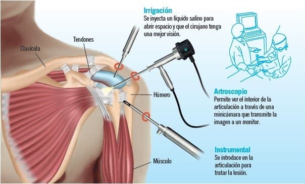 Encuentra a tu traumatólogo para lesiones de hombro en Almería