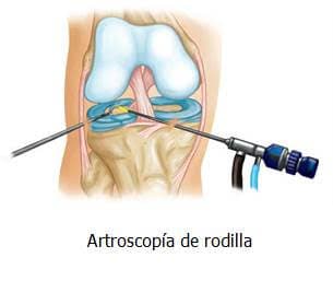 Encuentra a tu traumatólogo para lesiones de rodilla en Almería